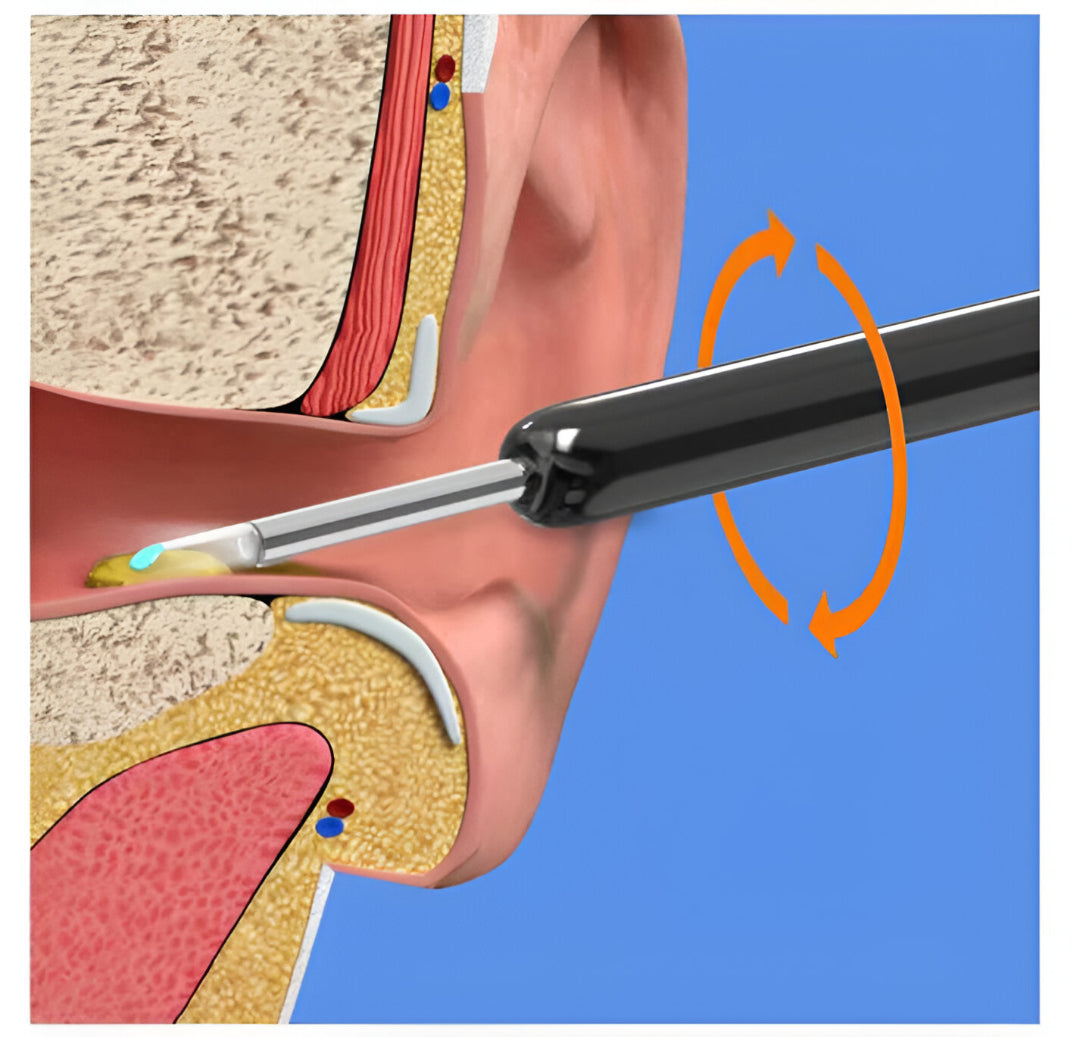 Earwax Removal Kit